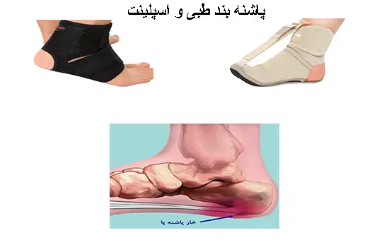 خار پاشنه می تواند به طور مستقل رخ دهد یا با یک بیماری زمینه ای مرتبط باشد. تشخیص تشخیص زود خار پاشنه چیست؟
هنگام خار پاشنه برای بهبودی سریع تر تاثیر زیادی دارد.