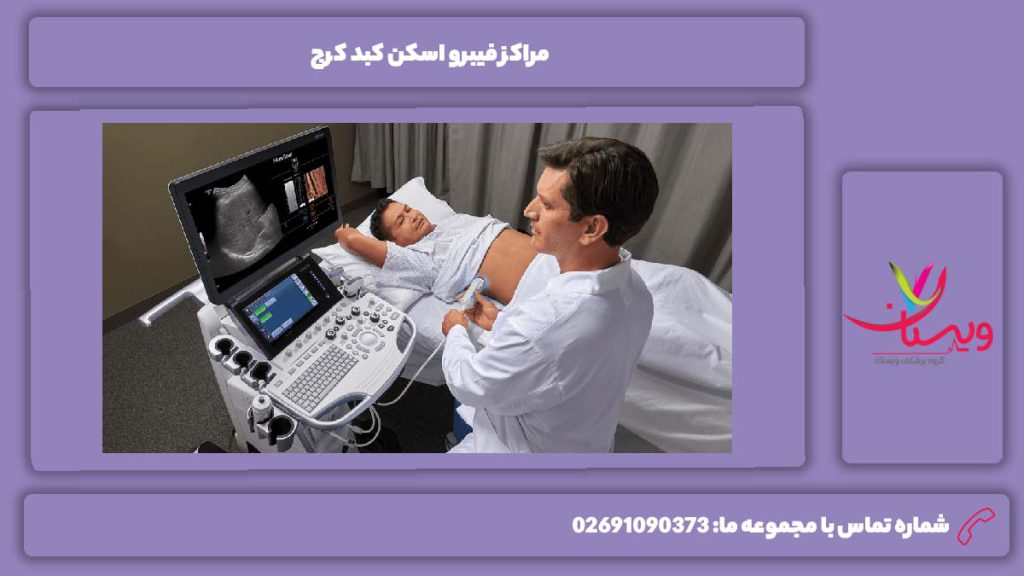 مراکز مهم کرج فیبرو اسکن کبد کرج