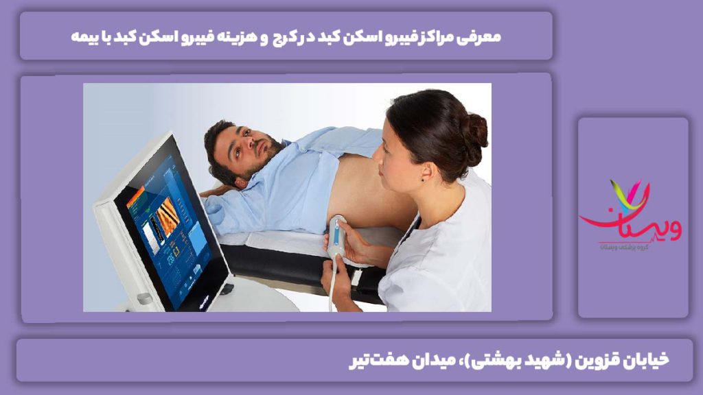 فیبرو اسکن کبد کرج