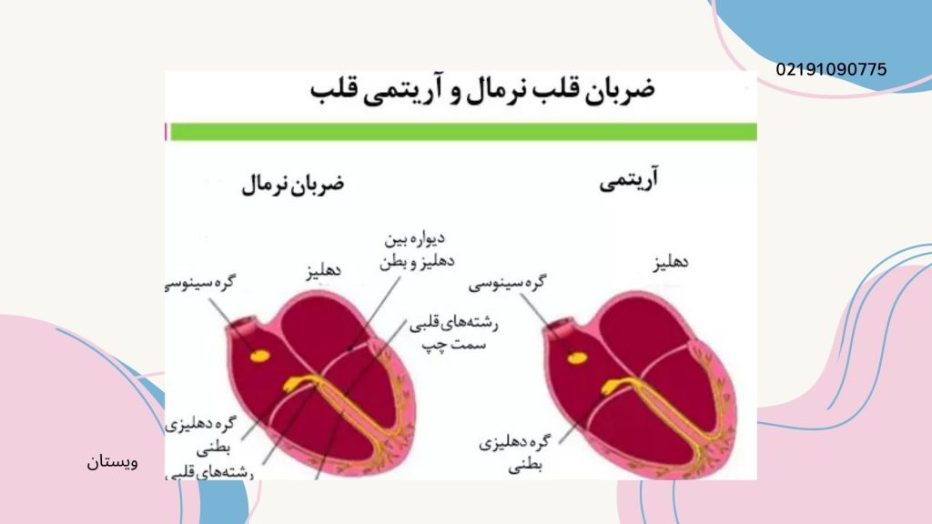 معمولا اختلالات انواع آریتمی قلبی دردناک نیستند.