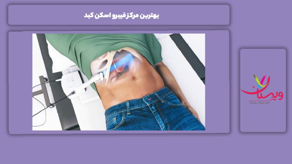 خوبترین مراکز اسکن کبد بهترین مرکز فیبرو اسکن کبد