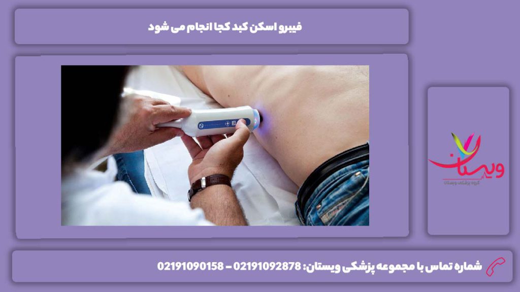 ویژگیهای انواع مراکز فیبرو اسکن کبد کجا انجام می شود