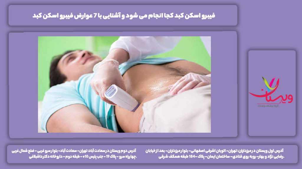 فیبرو اسکن کبد کجا انجام می شود