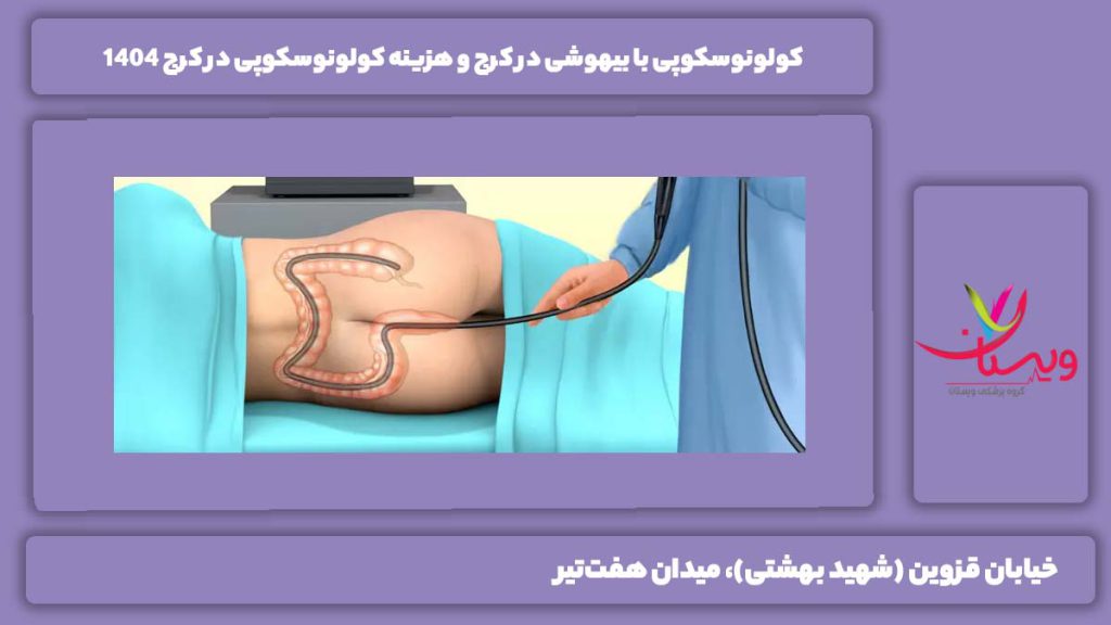 کولونوسکوپی با بیهوشی در کرج