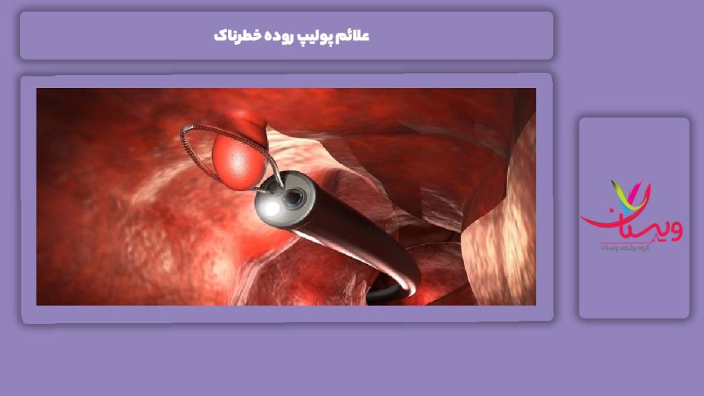 نشانههای پولیپ روده خطرناک علائم پولیپ روده خطرناک