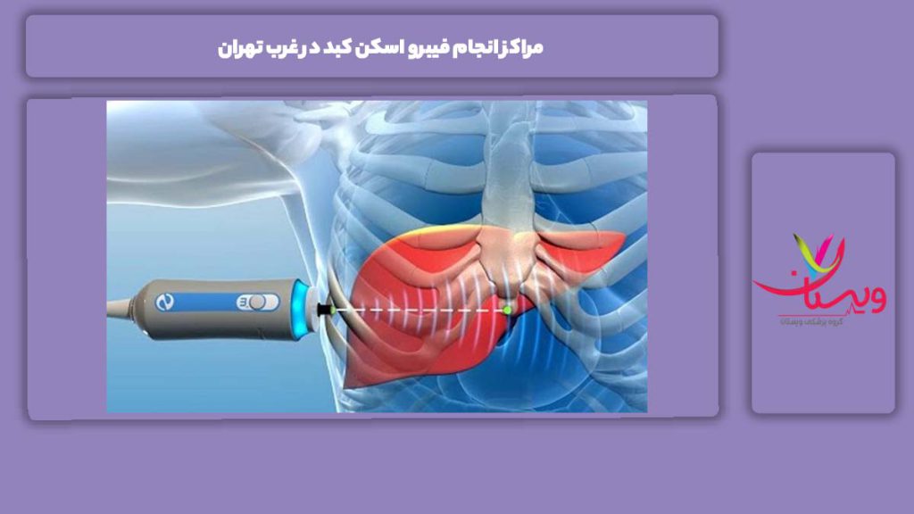 مزایای انجام فیبرو اسکن کبد در غرب تهران مراکز انجام فیبرو اسکن کبد در غرب تهران