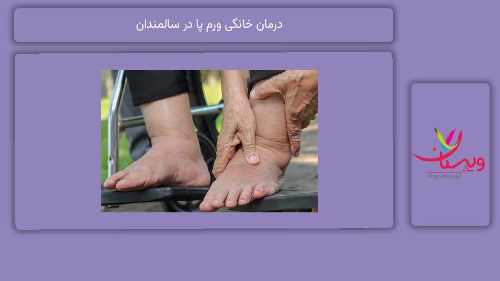 خوب شدن ورم پای سالمندان در خانه 9 درمان خانگی ورم پا در سالمندان