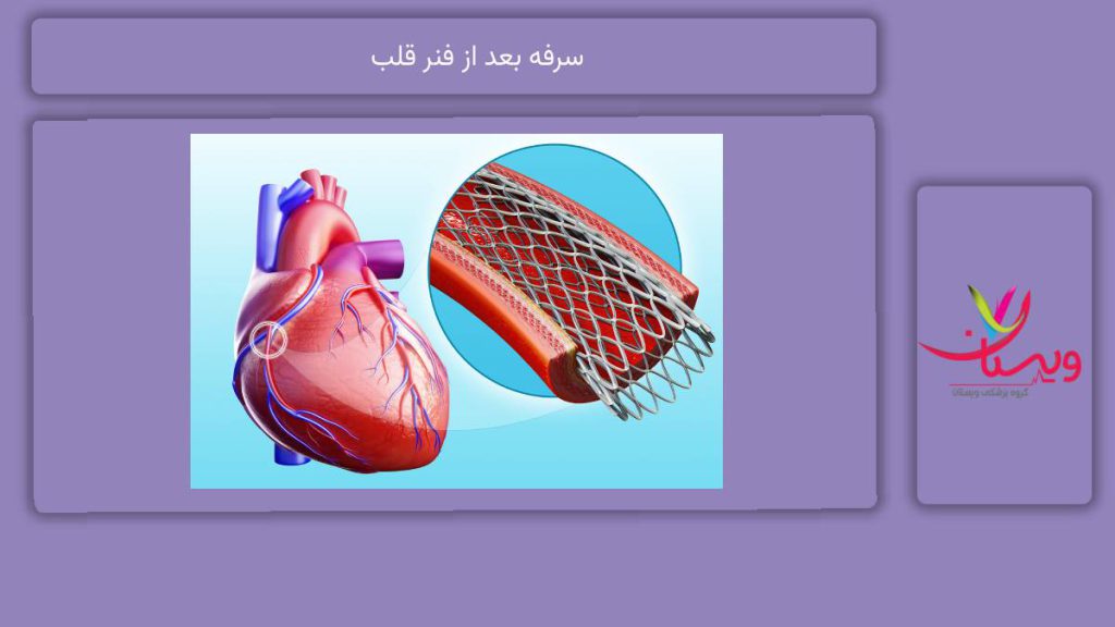 راهکارهای کاهش سرفه سرفه بعد از فنر قلب