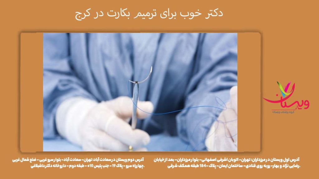 پزشک زنان و زیبایی کرج دكتر خوب برای ترميم بكارت در کرج