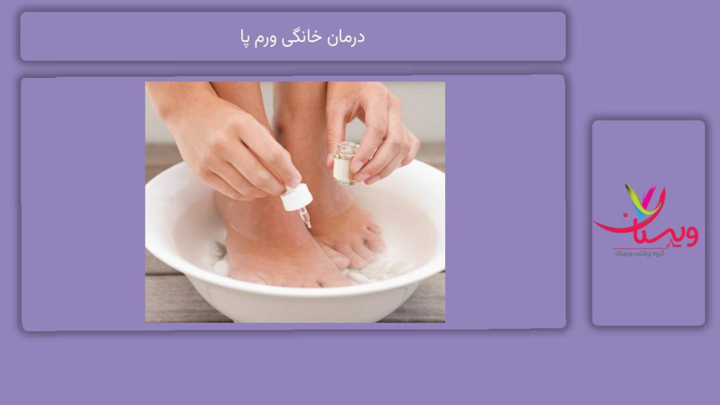 خوب کردن ورم در منزل درمان خانگی ورم پا