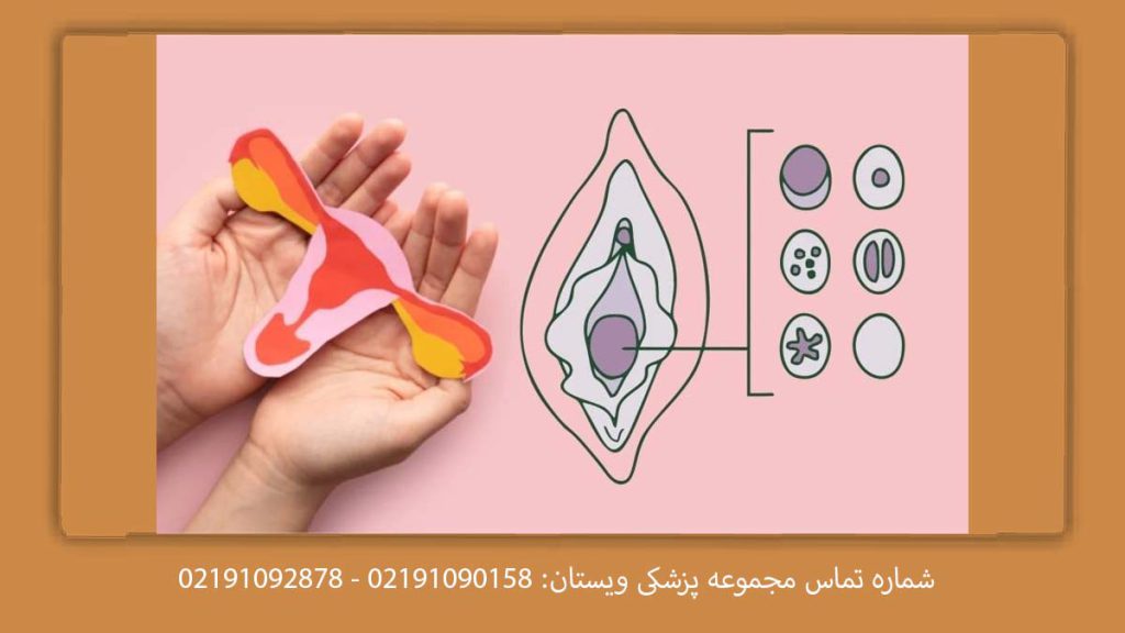 رعایت مراقبتهای بعد از ترمیم بکارت توصیههای مراقبتی دكتر خوب برای ترميم بكارت در تهران