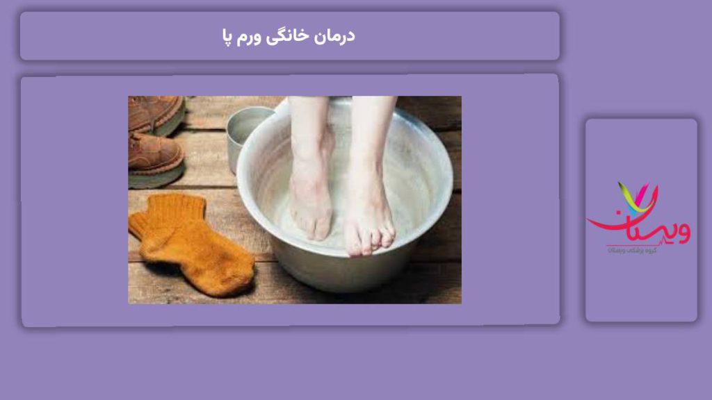 مؤثرترین روشهای درمان خانگی ورم پا درمان خانگی ورم پا