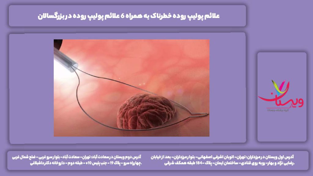 علائم پولیپ روده خطرناک