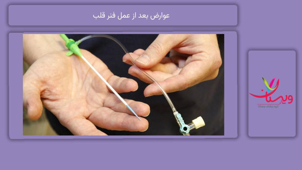ضررهای بعد از این عمل عوارض بعد از عمل فنر قلب