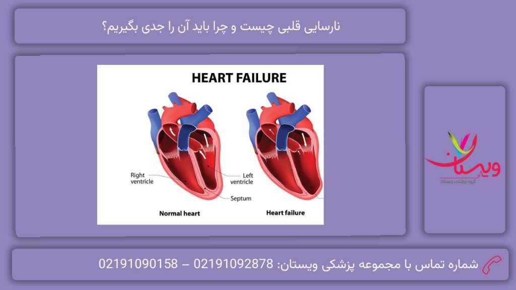 علتهای اصلی این بیماری نارسایی قلبی چیست