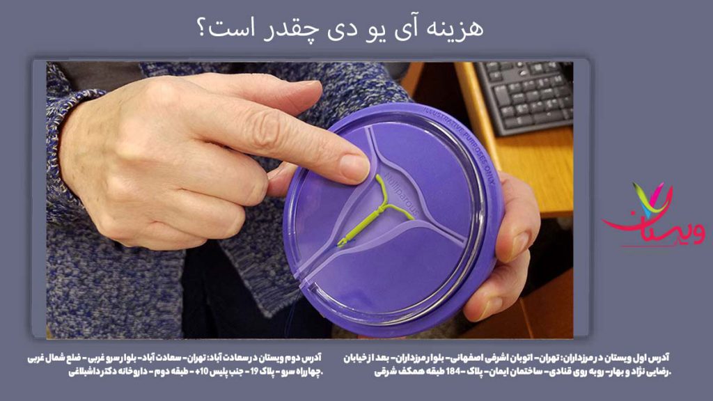 هزینه گذاشتن iud