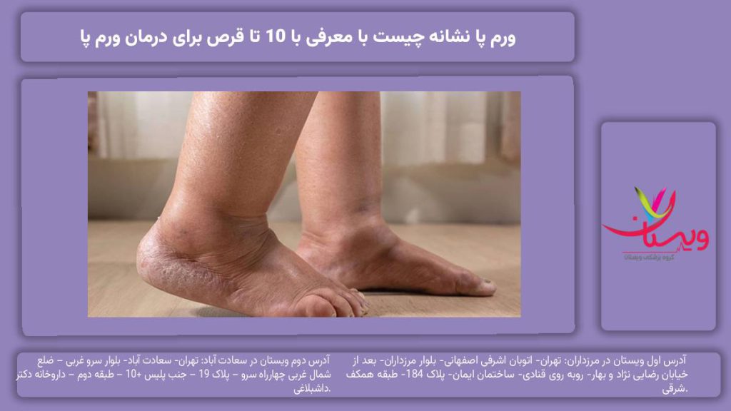 ورم پا نشانه چیست