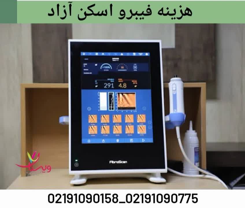 قیمت انجام فیبرو اسکن کبد بهصورت آزاد در مراکز درمانی. هزینه فیبرو اسکن کبد آزاد