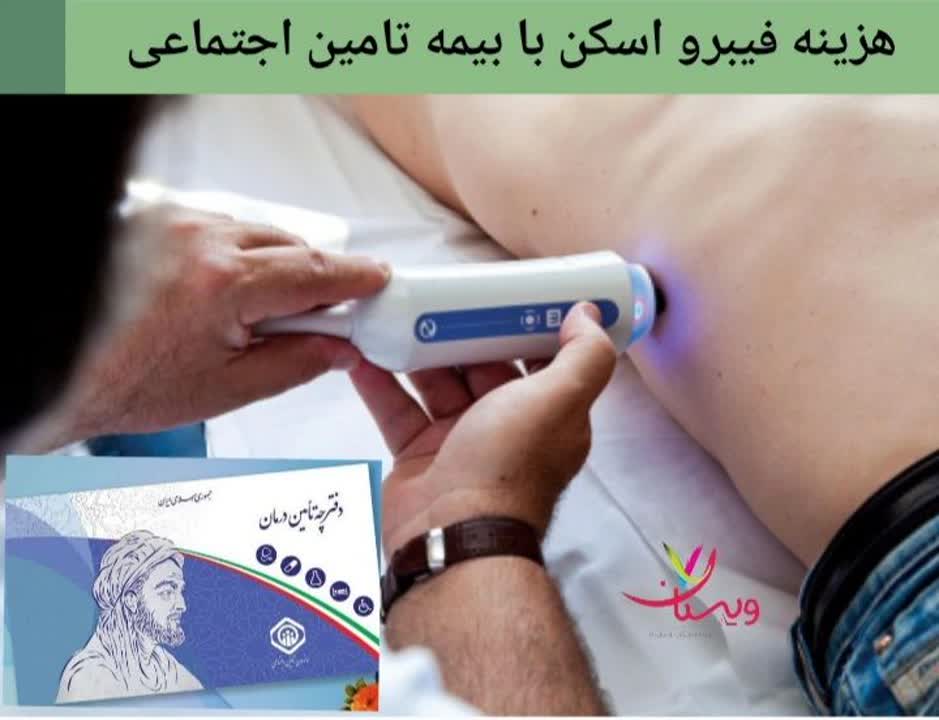 تعرفه فیبرو اسکن کبد برای بیمهشدگان سازمان تامین اجتماعی هزینه فیبرو اسکن کبد با بیمه تامین اجتماعی